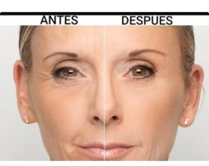 SERUM DE RETINOL - ANTIARRUGAS + REGALO JABON DE CURCUMA PARA EL ACNE