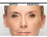 SERUM DE RETINOL - ANTIARRUGAS + REGALO JABON DE CURCUMA PARA EL ACNE
