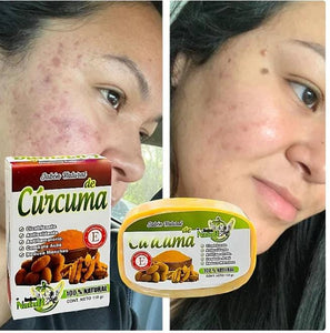 ✨PROMOCION 4 JABON DE CURCUMA + 1 JABON DE ARROZ DE REGALO✨🛍️📲